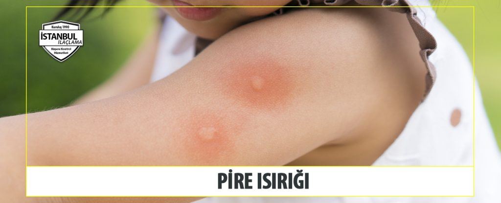 Pire Isırığı