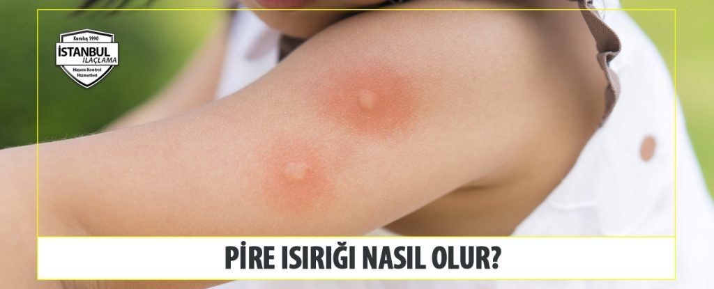 Pire Isırığı Nasıl Olur