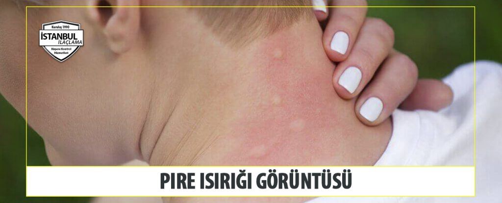 pire isirigi goruntusu